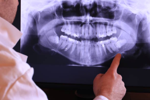 Professional Emergency Dental Service in IL